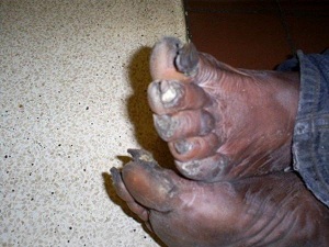 ugly-feet-2.jpg