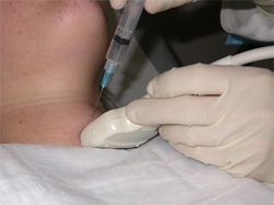 pic_fna_nodule.jpg