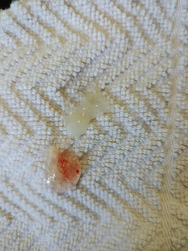 mucus-blood.jpg