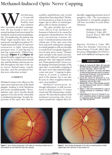 babash-methanol-opticnerve.png